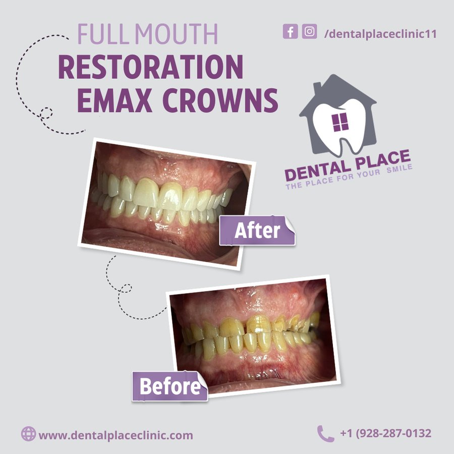 مكان طب الأسنان - DENTAL PLACE